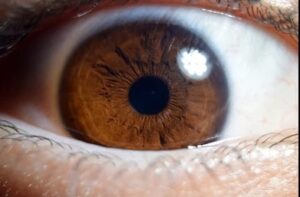why opioids make your pupils small 